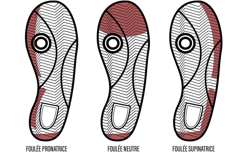 foulée-pronatrice-universelle-supinatrice